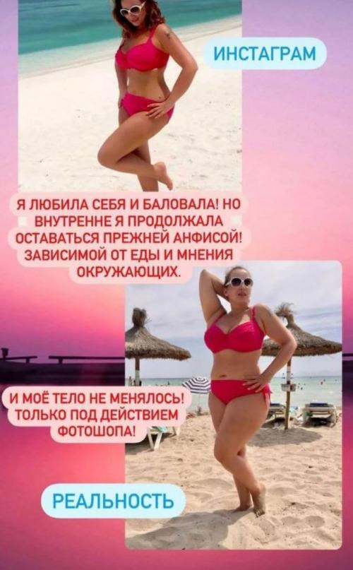 Растолстевшая до 100 килограммов Анфиса Чехова вызвала грандиозный скандал 01