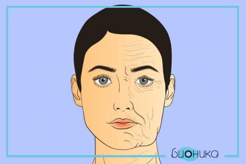 Когда виден эффект от ботокса на лбу и между бровями. Факторы, влияющие на продолжительность эффекта от ботокса 01