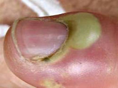 Обработка ушей после прокола хлоргексидином. Цены на услуги