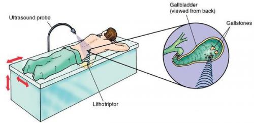 Что едят при панкреатите. Список продуктов и блюда при диетическом столе №5 П 10 Что едят при панкреатите. Список продуктов и блюда при диетическом столе №5 П 10