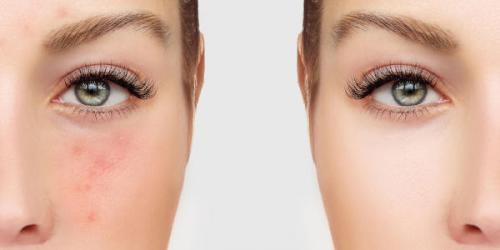 Советы косметолога по уходу за кожей на каждый день. Ежедневный уход за кожей 11