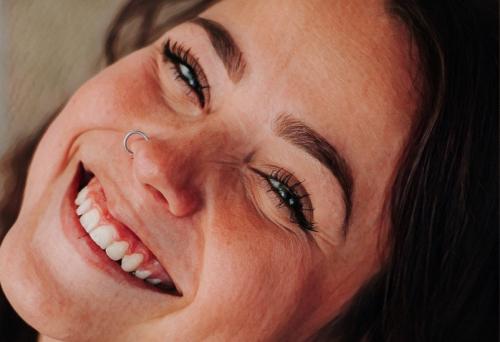 О чем говорят морщины вокруг рта. Типы морщин вокруг рта