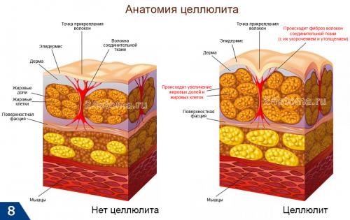 LPG массаж до и после. Оптимальные показания к LPG-массажу  –