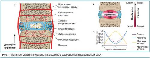 Препараты для восстановления хрящевой ткани коленного сустава. Эффективны ли хондропротекторы