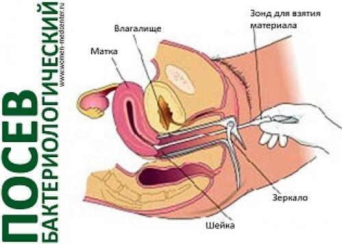 Женское здоровье: как сохранить равновесие и гармонию в организме 05 Женское здоровье: как сохранить равновесие и гармонию в организме 05