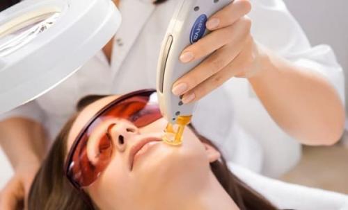 Сколько нужно процедур для лазерной эпиляции. Как определить период роста волос и время, через которое нужно приходить на эпиляцию? 02