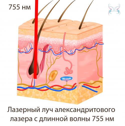 Сколько длится лазерная эпиляция. Содержание: