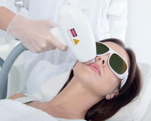 Эффектные результаты после лазерной эпиляции: что ожидать 03