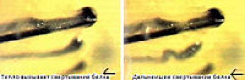 Травы при гирсутизме. Гирсутизм у женщин: причины и способы лечения 01 Травы при гирсутизме. Гирсутизм у женщин: причины и способы лечения 01