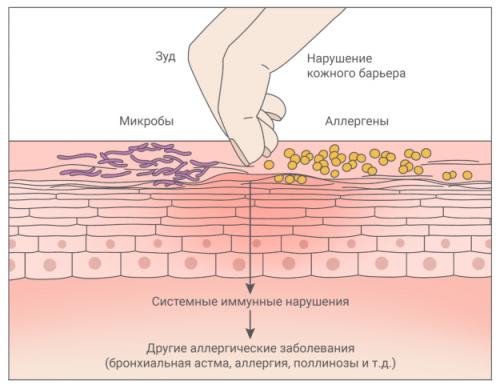 Что такое зуд при заболеваниях внутренних органов. Почему чешется кожа?