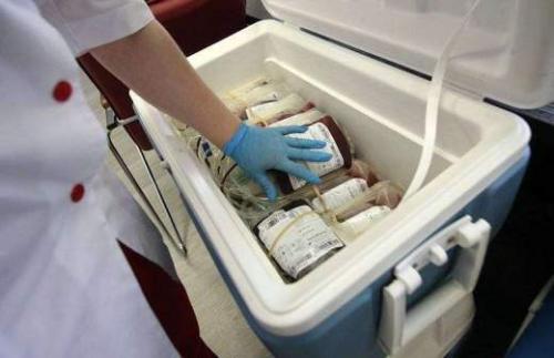 Зачем выпивать стакан воды утром натощак. Врач Кононенко рассказала, зачем на самом деле нужно выпивать с утра стакан воды натощак 02 Зачем выпивать стакан воды утром натощак. Врач Кононенко рассказала, зачем на самом деле нужно выпивать с утра стакан воды натощак 02