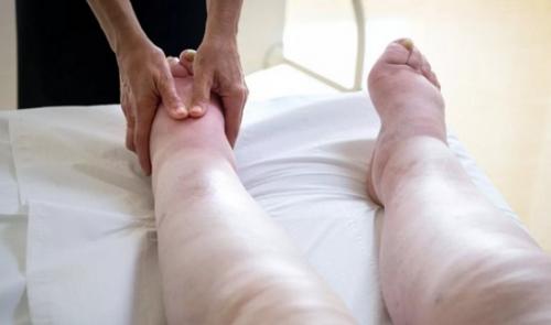 Лимфодренажный массаж противопоказания. Лимфодренажный массаж при лимфедеме