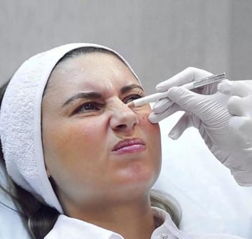 Как долго держится Ботокс и как продлить эффект. 3) Нарушение условий хранения (после разведения)  – 14